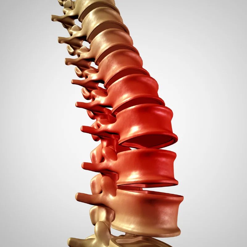 stem cell therapy for sciatica pain