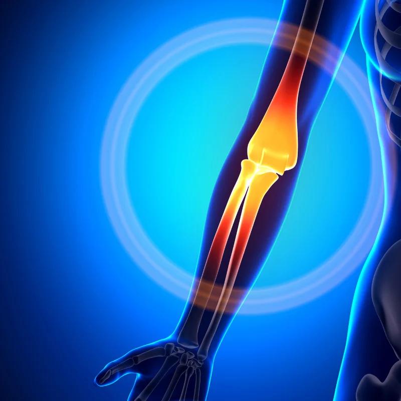 stem cell therapy for elbow pain
