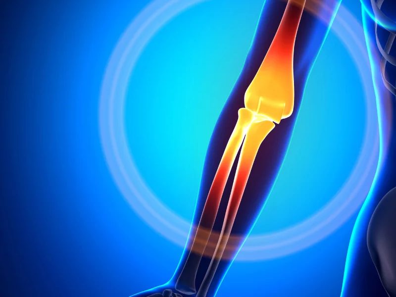 stem cell therapy for elbow pain