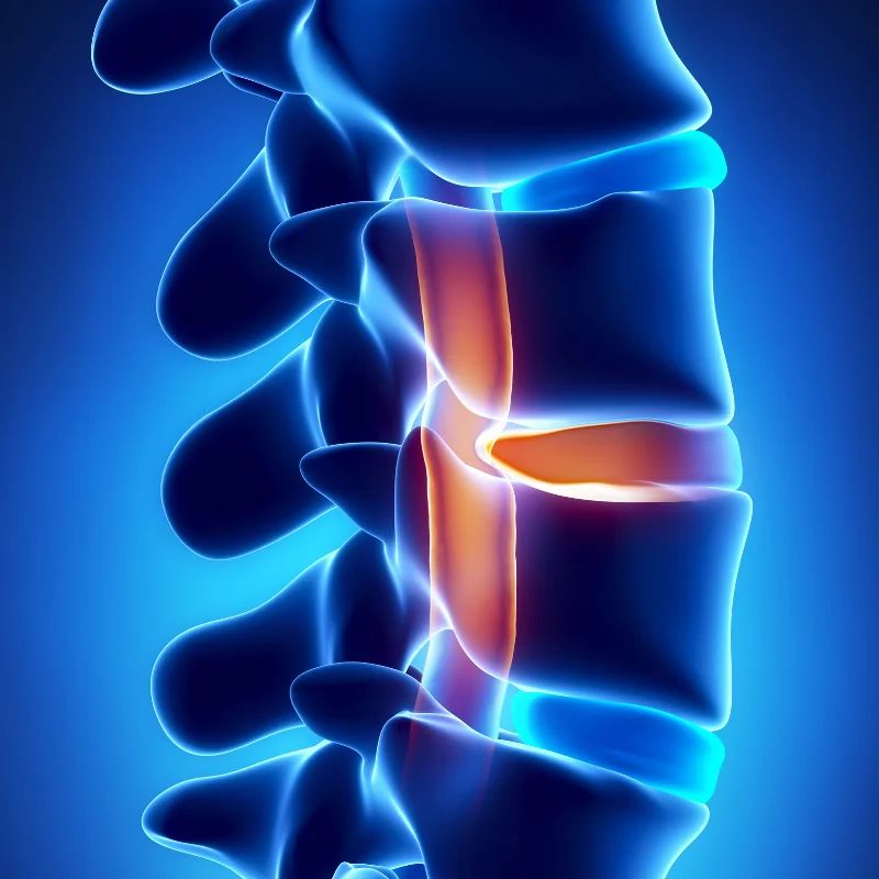disc pain stem cell therapy