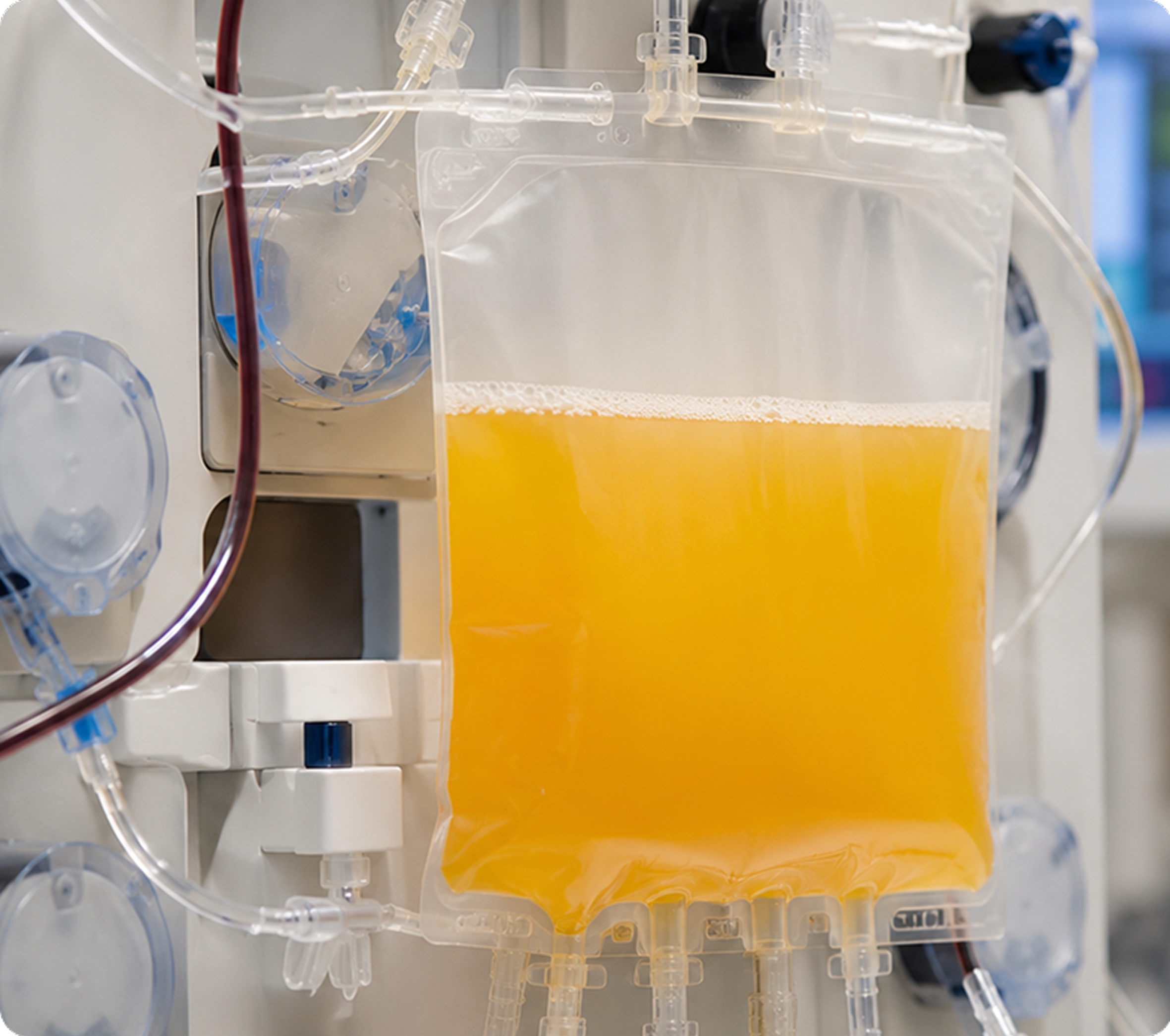 TPE therapeutic plasma exchange session — clinic photography