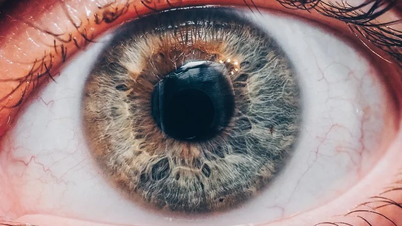 Plasmapheresis for Optic Neuritis: Treatment and Recovery