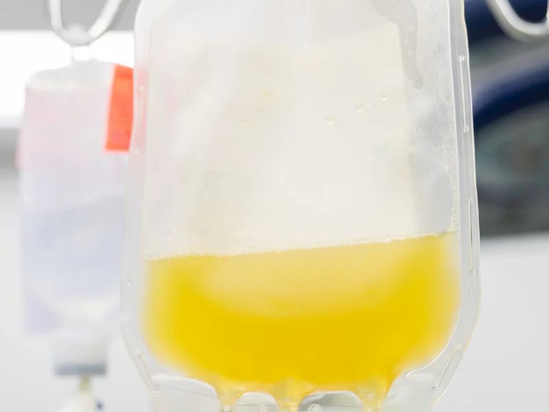 plasma exchange vs plasmapheresis
