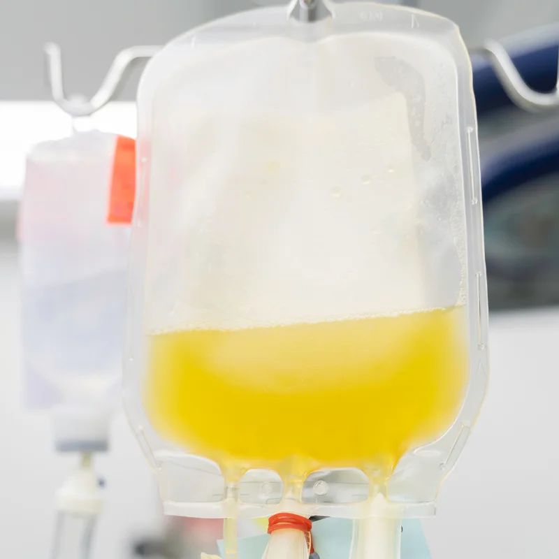 plasmapheresis for pancreatitis