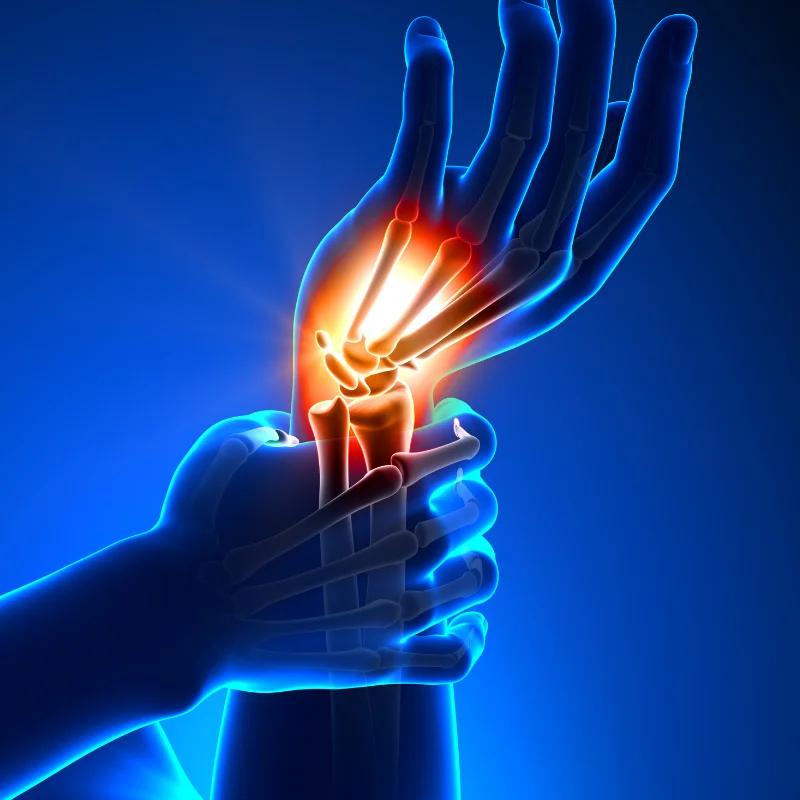 Stem Cell Therapy for Wrist Pain