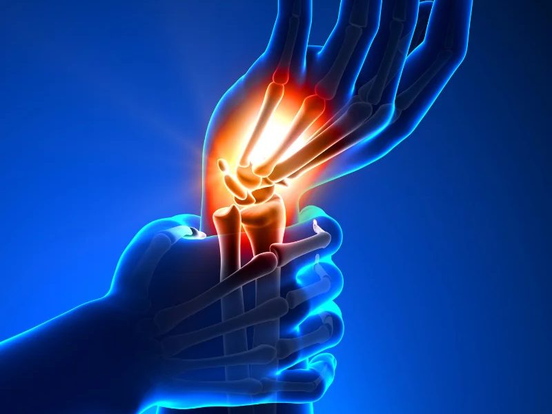 Stem Cell Therapy for Wrist Pain