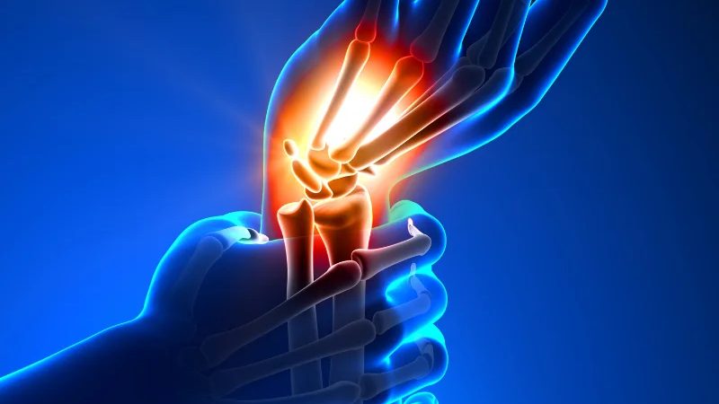 Stem Cell Therapy for Wrist Pain