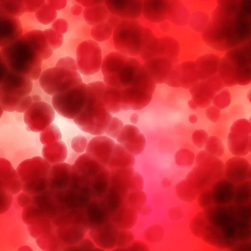 IVIG vs plasmapheresis