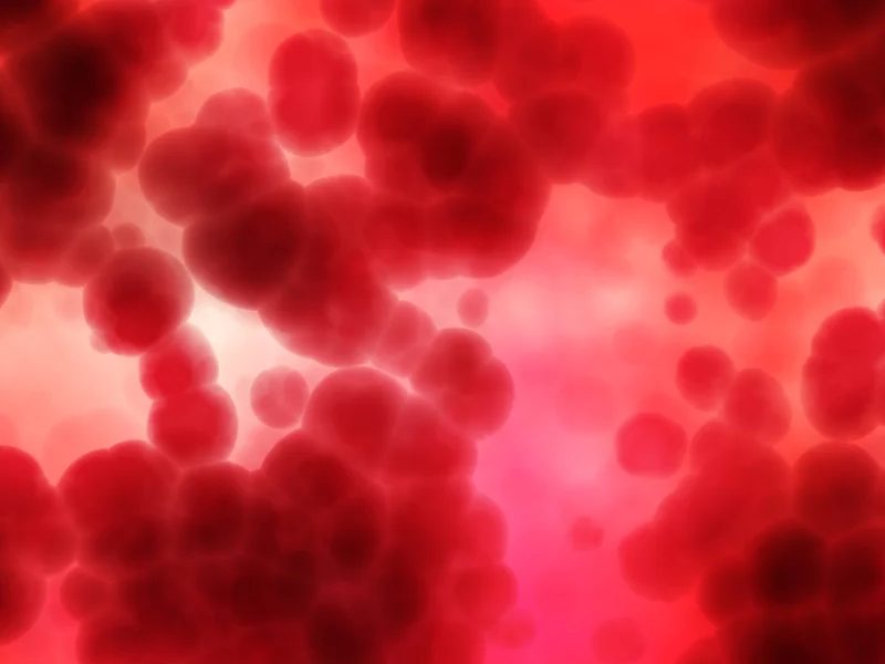 IVIG vs plasmapheresis