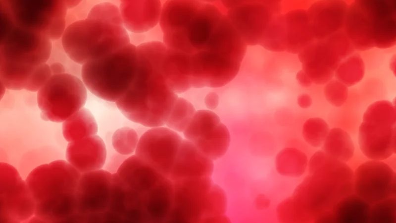 IVIG vs plasmapheresis