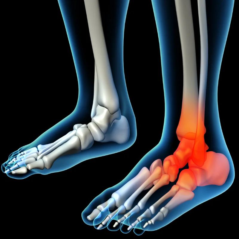 stem cell therapy for golfers elbow