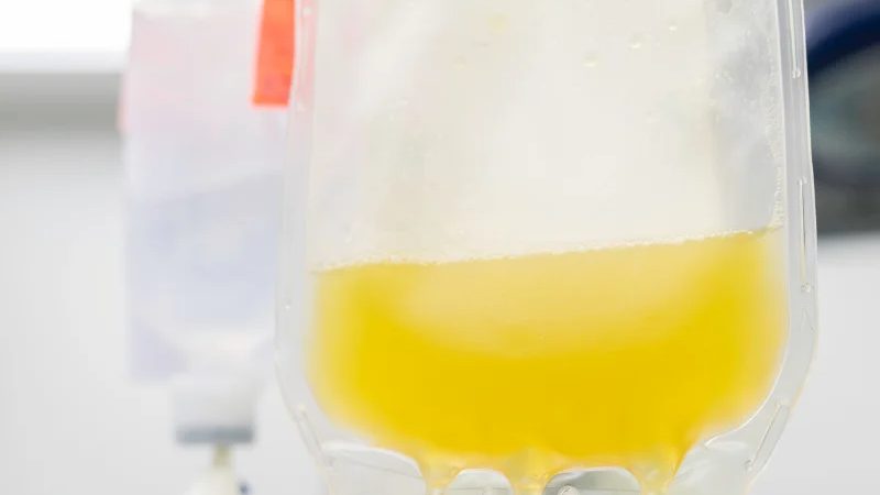 Plasmapheresis vs Plasma Donation