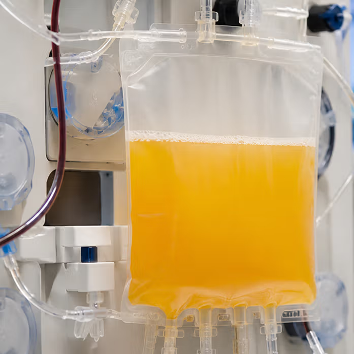 Photopheresis vs Plasmapheresis