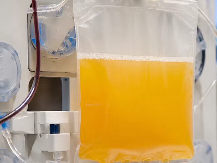 Photopheresis vs Plasmapheresis
