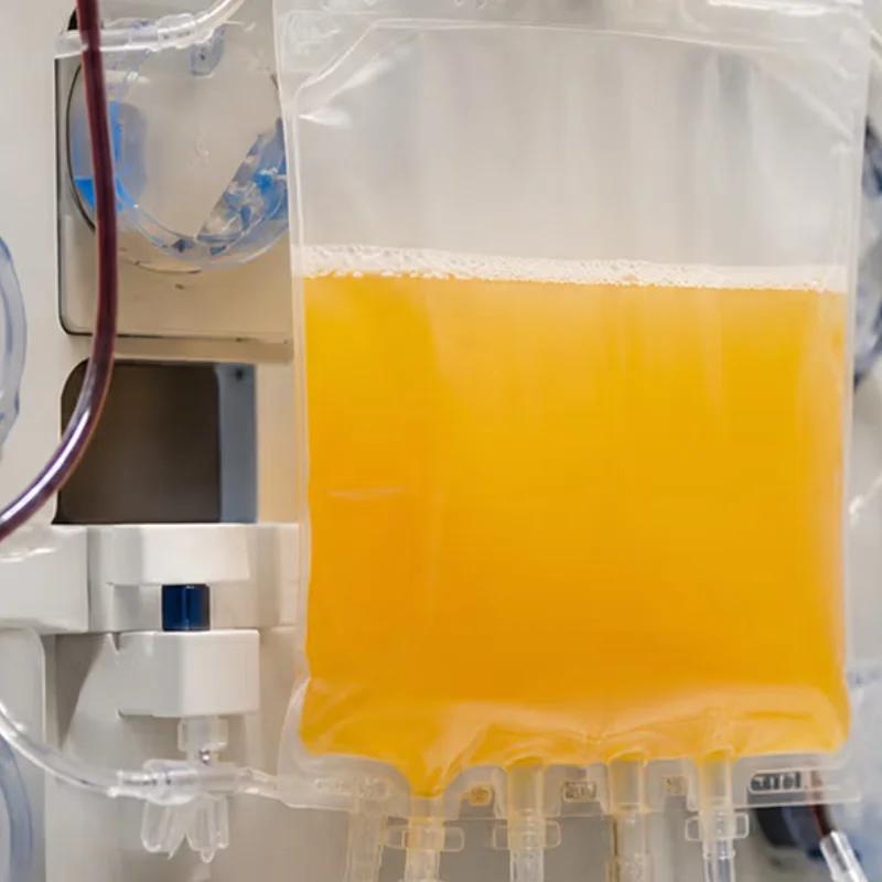 Apheresis vs plasmapheresis