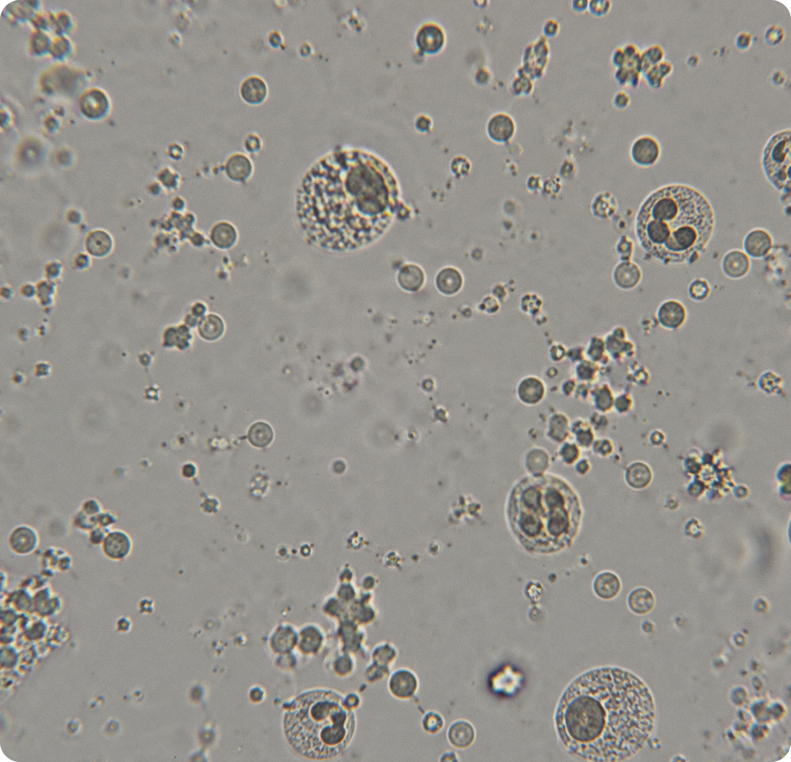 Microscope view of blood cells and plasma