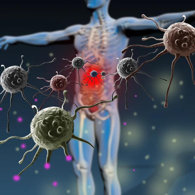 Plasmapheresis for Myasthenia Gravis: How It Works and Benefits