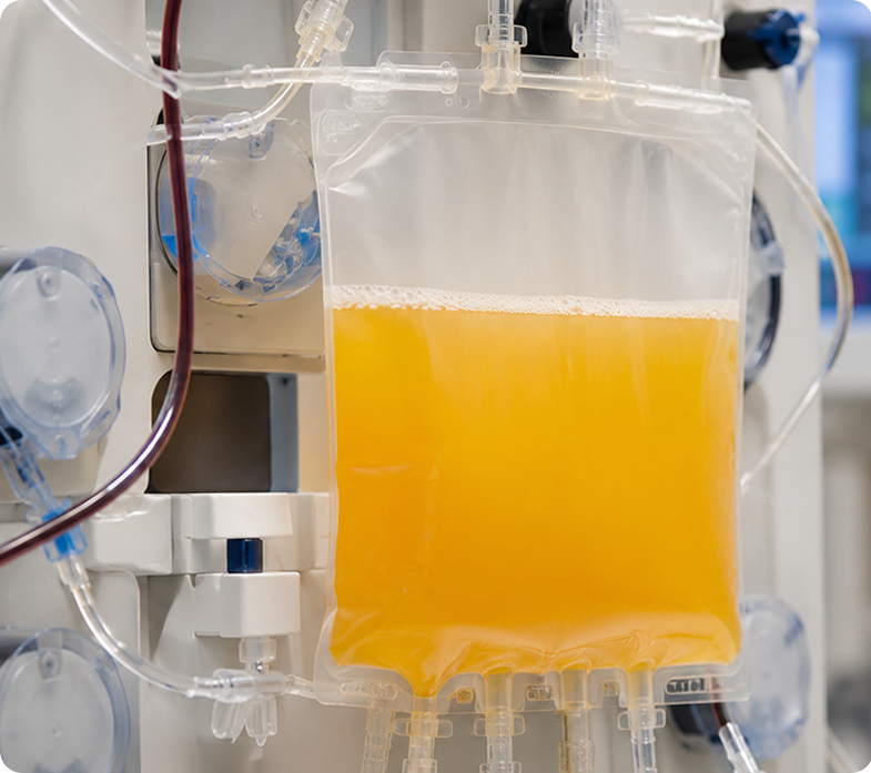Bag of separated yellow plasma hanging in a clinical filtration setup